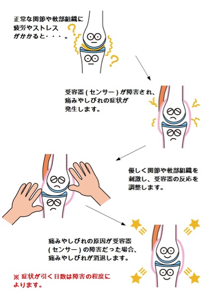 JOINT PAIN（関節の痛み） 関節痛（指・膝・股関節・手首・足首・肩）｜鶴見駅前リウマチ・内科