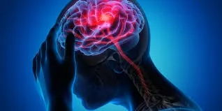 「はり灸で脳卒中・認知症予防」鍼灸ネットワーク