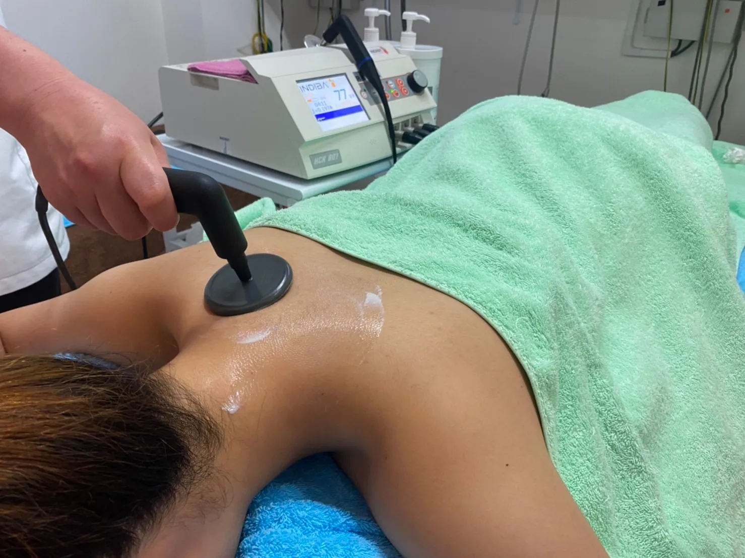 インディバ温熱療法 (INDIBA) 15分 2,000円～