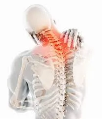 頚椎へルニア　腕、肩甲、前胸部の痛み　40歳　自営業