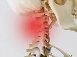 首の痛み　腰痛　４１歳　女性　看護師