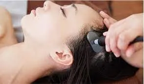 脱毛症への鍼灸とインディバ併用治療効果