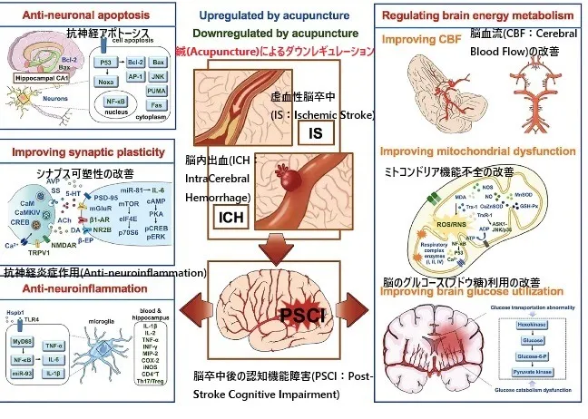【鍼灸EBM最前線：鍼のエビデンスの現状「鍼がポジティブな効果を出す可能性が高い疾患」(19)「脳卒中後の認知機能障害」】