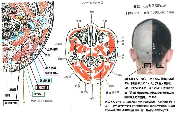【天柱(てんちゅう)】
