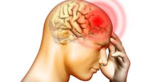 片頭痛の特徴はズキンズキンとした痛みが長く続く